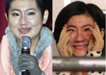 任家萱和张轩睿在一起了吗,任家萱烧伤前后对比照 任家萱和张轩睿在一起了吗,任家萱烧伤前后对比照